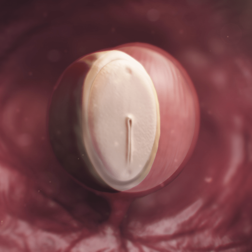 4 HƏFTƏ HAMİLƏLİK